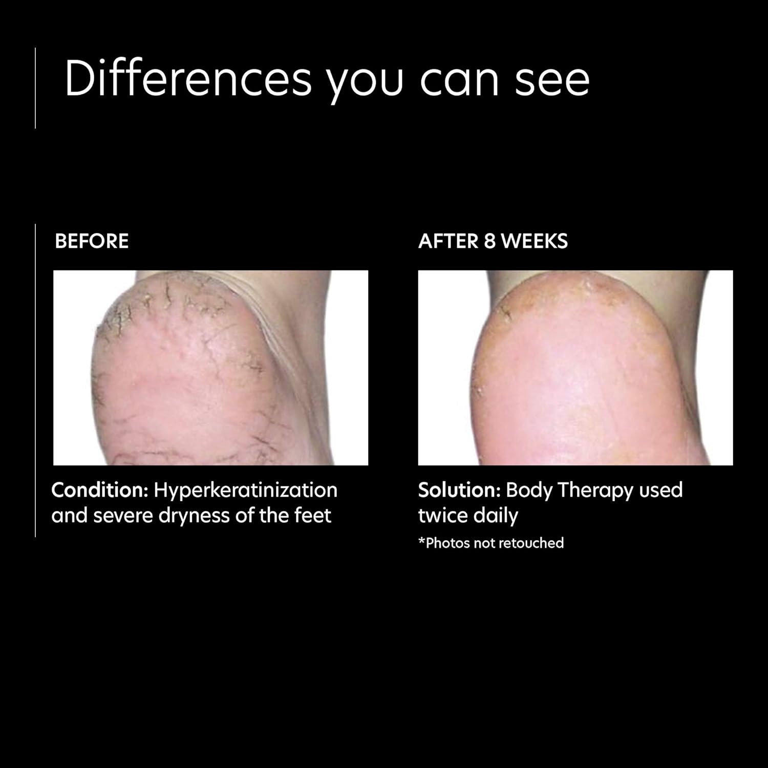 image:imagePCA SKIN Daily Body Therapy Lotion Rich 12 Lactic Acid Moisturizing Cream to Nourish Dry Skin FragranceFree NonGreasy Formula 7 oz