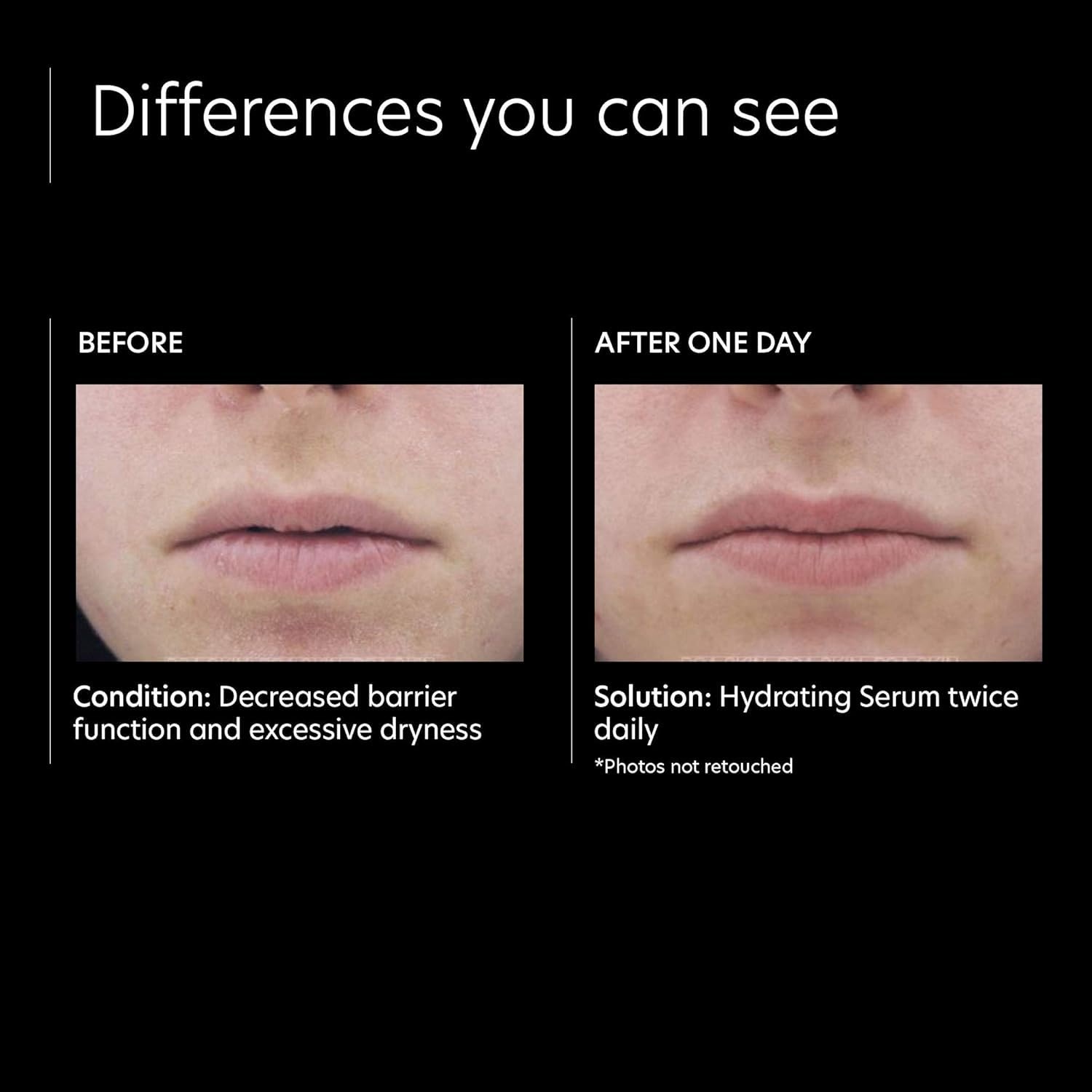 image:imagePCA SKIN Hydrating Serum Sensitive Skin Face Moisturizer Gently Nourishes and Hydrates Sensitive Skin 1 fl oz Pump