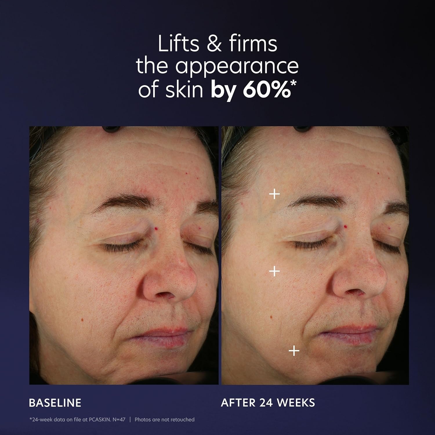 image:imagePCA SKIN Pro Max Age Renewal Anti Aging Serum Anti Aging Face Serum for Reducing Wrinkles and Sagging Skin Helps Lift and Firm Skin on Face and Neck Safe For All Skin Types1 Fl Oz Pack of 1