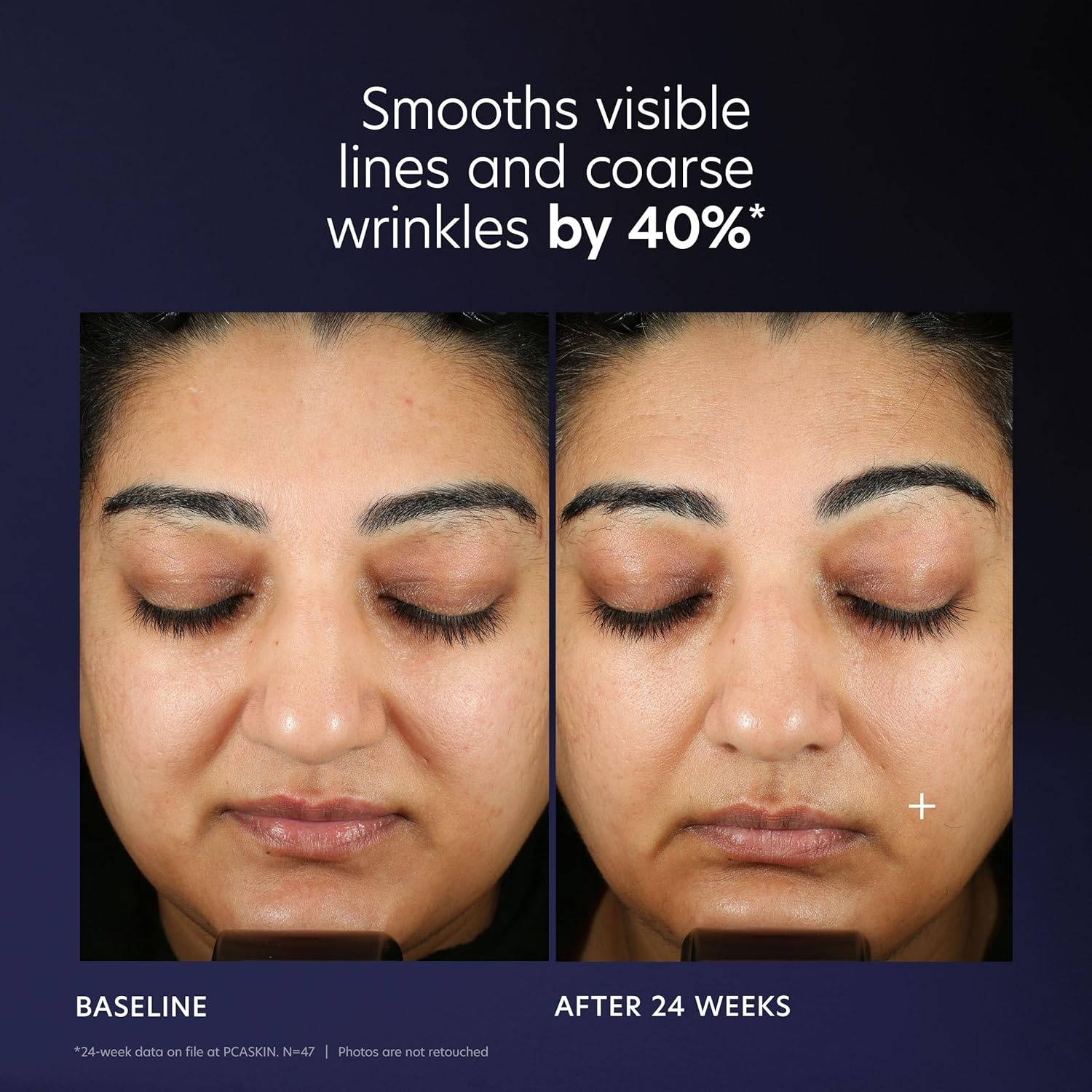 image:imagePCA SKIN Pro Max Age Renewal Anti Aging Serum Anti Aging Face Serum for Reducing Wrinkles and Sagging Skin Helps Lift and Firm Skin on Face and Neck Safe For All Skin Types1 Fl Oz Pack of 1
