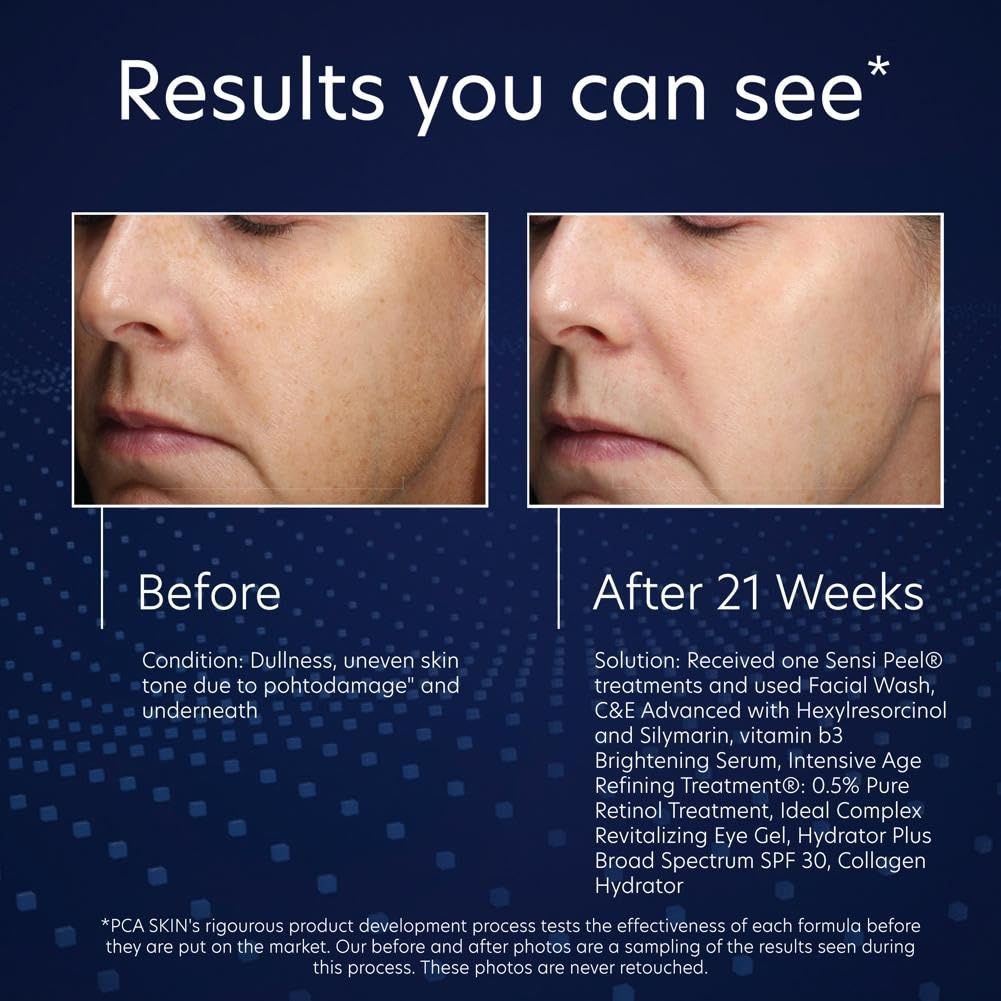 image:imagePCA SKIN Vitamin B3 Brightening Serum Anti Aging Serum for Dark Spots and Skin Discoloration Made with Hydrating Niacinamide and Antioxidants Helps Minimize Redness and Uneven Skin Tones 10 Pump