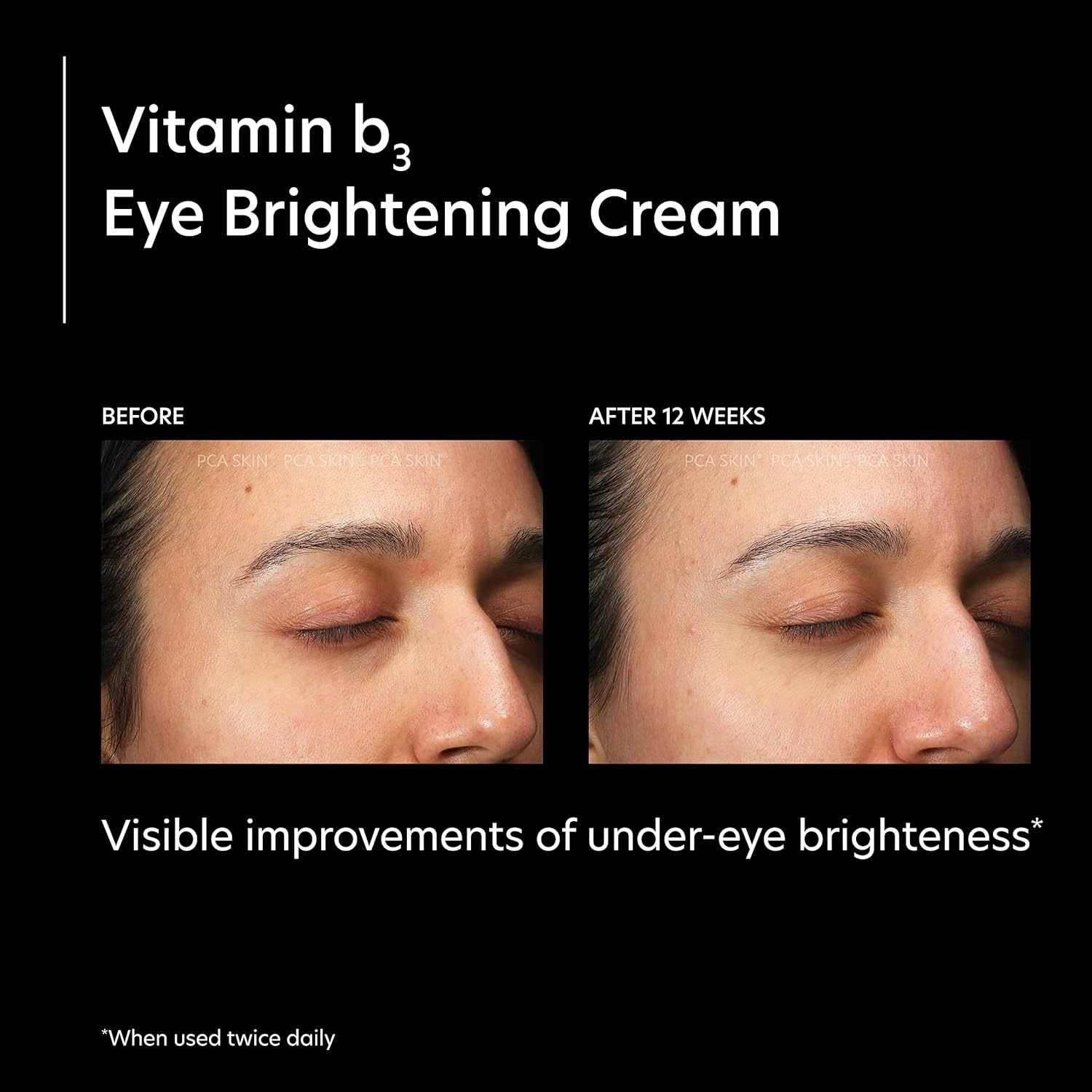 image:imagePCA SKIN Vitamin B3 Eye Brightening Cream Eye Brightener For Bright Eyes Dark Circles Wrinkles and Uneven Skin Tones Anti Aging Eye Cream Formulated with Niacinamide 1 oz Tube