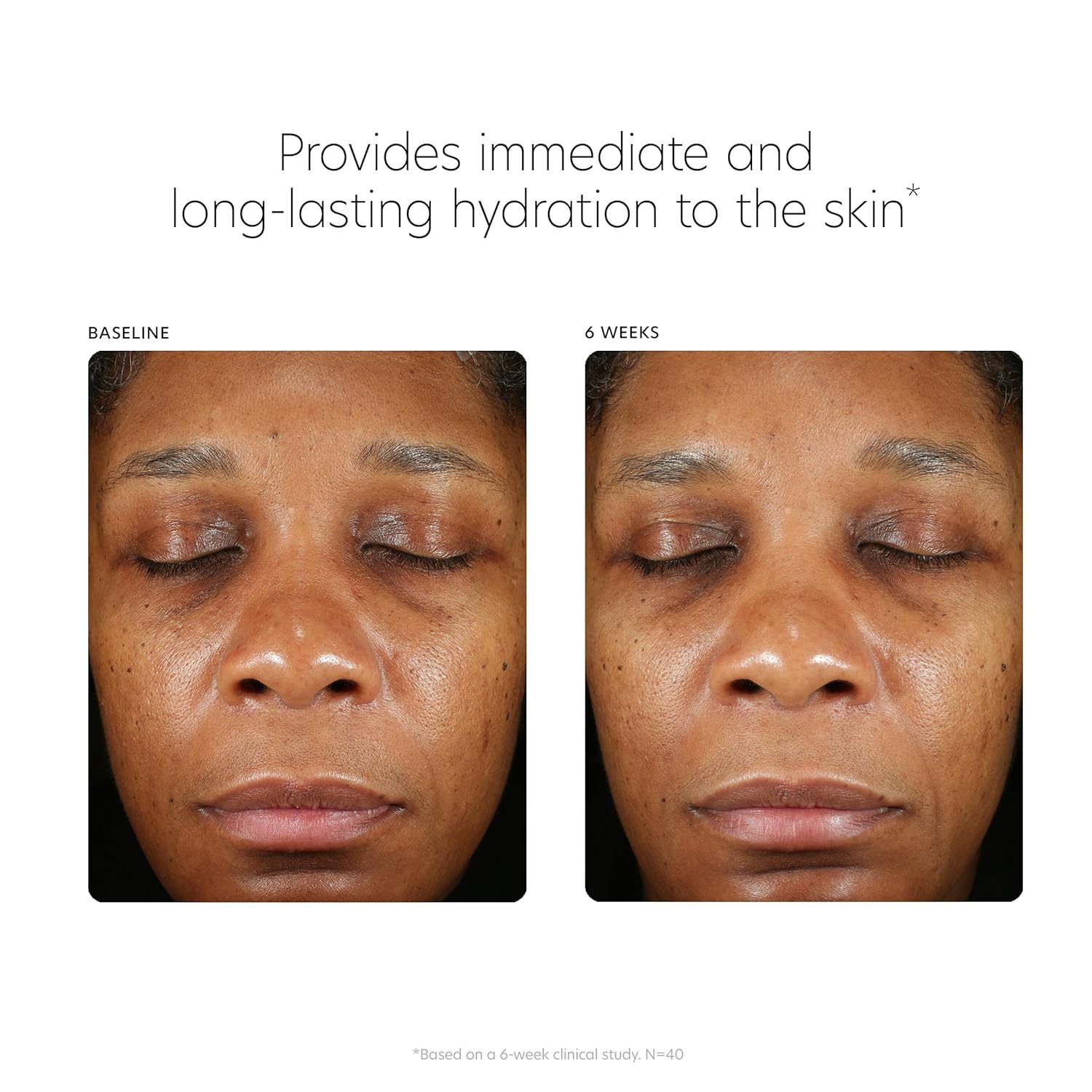 image:imagePCA SKIN Hyaluronic Acid Boosting Face Serum Hyaluronic Acid Serum for Face Made with Niacinamide and Ceramides Helps Reduce Fine Lines and Wrinkles and Delivers 24Hour Moisturization 1 oz Pump3 fl oz